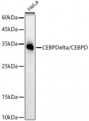 CEBP Delta/CEBPD Rabbit mAb (A21954)
