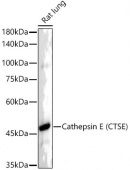 Cathepsin E (CTSE) Rabbit mAb (A22092)