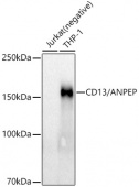 CD13/ANPEP Rabbit mAb (A21268)