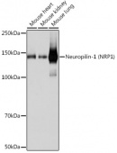 Neuropilin-1 (NRP1) Rabbit mAb (A19087)