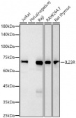 IL23R Rabbit mAb (A22561)
