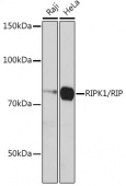 RIPK1/RIP Rabbit mAb (A19580)