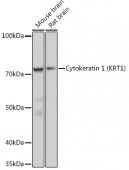 Cytokeratin 1 (KRT1) Rabbit mAb (A9776)