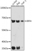 IRF4 Rabbit mAb (A5215)