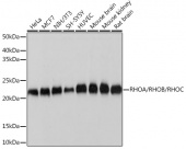 RHOA/RHOB/RHOC Rabbit mAb (A4855)