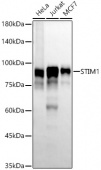 STIM1 Rabbit mAb (A22488)