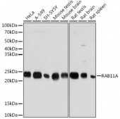 RAB11A Rabbit mAb (A3251)