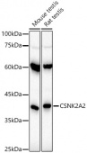 CSNK2A2 Rabbit mAb (A20791)