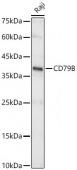 CD79B Rabbit mAb (A23790)