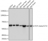 TCP1 beta/CCT2 Rabbit mAb (A4700)