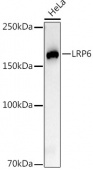 LRP6 Rabbit mAb (A22661)