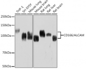 CD166/ALCAM Rabbit mAb (A9727)