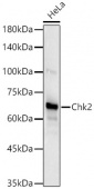 Chk2 Rabbit mAb (A19543)