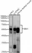 BIN1 Rabbit mAb (A21108)