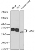 CD99 Rabbit mAb (A9791)