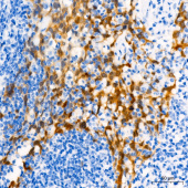 CDKN2A/p16INK4a Mouse mAb (A20371)