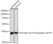 Prostatic Acid Phosphatase (ACPP) Rabbit mAb (A4138)