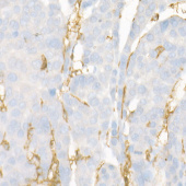 PDGFR alpha Rabbit mAb (A22220)