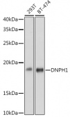 DNPH1 Rabbit mAb (A2382)