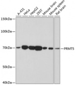 PRMT5 Rabbit mAb (A19533)