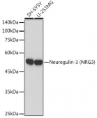 Neuregulin-3 (NRG3) Rabbit mAb (A19763)