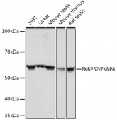 FKBP52/FKBP4 Rabbit mAb (A4356)