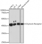 Oxytocin Receptor Rabbit mAb (A19740)