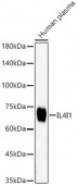 IL4I1 Rabbit mAb (A23151)