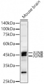 JUNB Rabbit mAb (A23225)