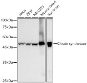 Citrate synthetase Rabbit mAb (A23371)