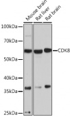CDK8 Rabbit mAb (A9654)
