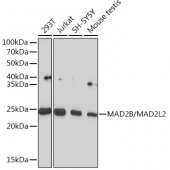 MAD2B/MAD2L2 Rabbit mAb (A4630)