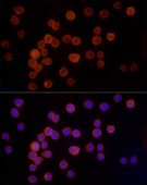 Cathepsin G Rabbit mAb (A22047)