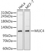 MUC4 Rabbit mAb (A3438)