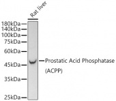 Prostatic Acid Phosphatase (PSAP)  Rabbit mAb (A21195)