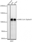 SARS-CoV-2 Spike S1 Rabbit mAb (A20834)