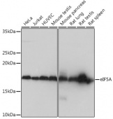 eIF5A Rabbit mAb (A4414)