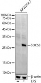 SOCS3 Rabbit mAb (A21981)