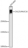 CA125 / MUC16 Rabbit mAb (A4666)