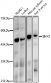 SNX5 Rabbit mAb (A21150)