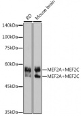 MEF2A+MEF2C Rabbit mAb (A2710)