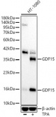 GDF15 Rabbit mAb (A22097)