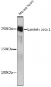 Laminin beta 1 Rabbit mAb (A4373)