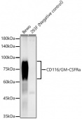 CD116/GM-CSFRα Rabbit mAb (A23001)
