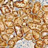 FUNDC1 Rabbit mAb (A22656)