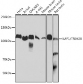 KAP1/TRIM28 Rabbit mAb (A19568)