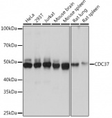 CDC37 Rabbit mAb (A4582)