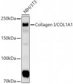 Collagen I/COL1A1 Rabbit mAb (A22090)