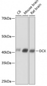 Doublecortin Rabbit mAb (A19042)