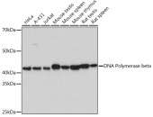 DNA Polymerase beta Rabbit mAb (A2412)